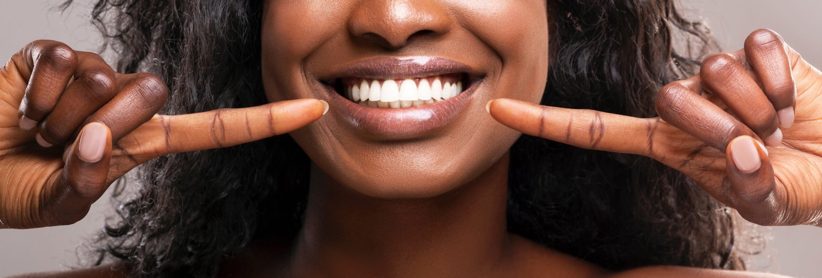 Close-up of a smiling black woman pointing to her bright, white teeth with both index fingers, advertising teeth whitening or cosmetic dentistry.