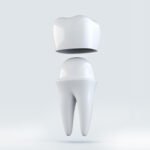 Illustration of a dental crown placed above a prepared tooth.
