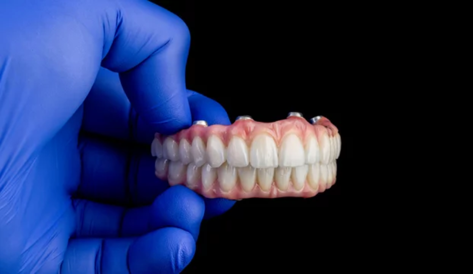 A gloved hand in blue holding a set of pink dentures with visible metal fasteners, against a black background.