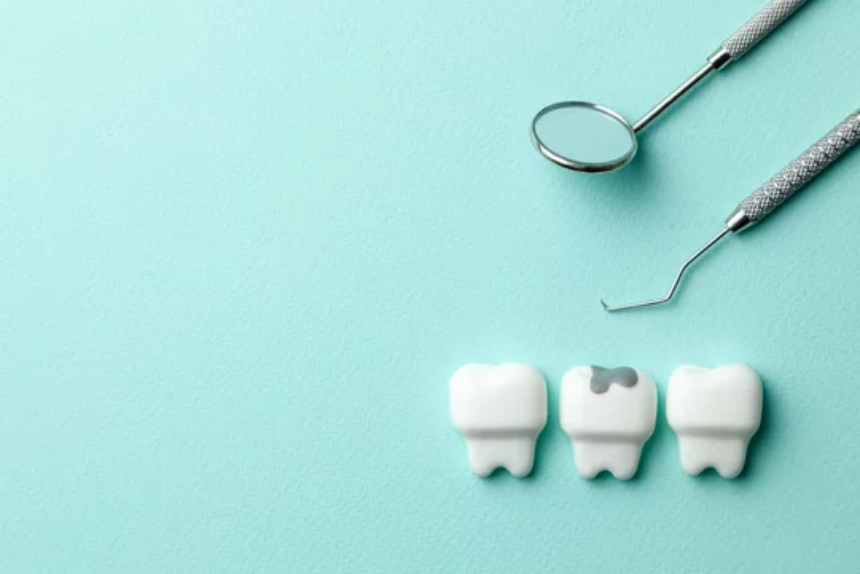 Three white molar teeth models, one with a gray cavity, alongside a dental mirror and probe, on a light blue background.